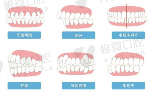 微创拔牙和普通拔牙（拔牙麻药多久消失）(图1)